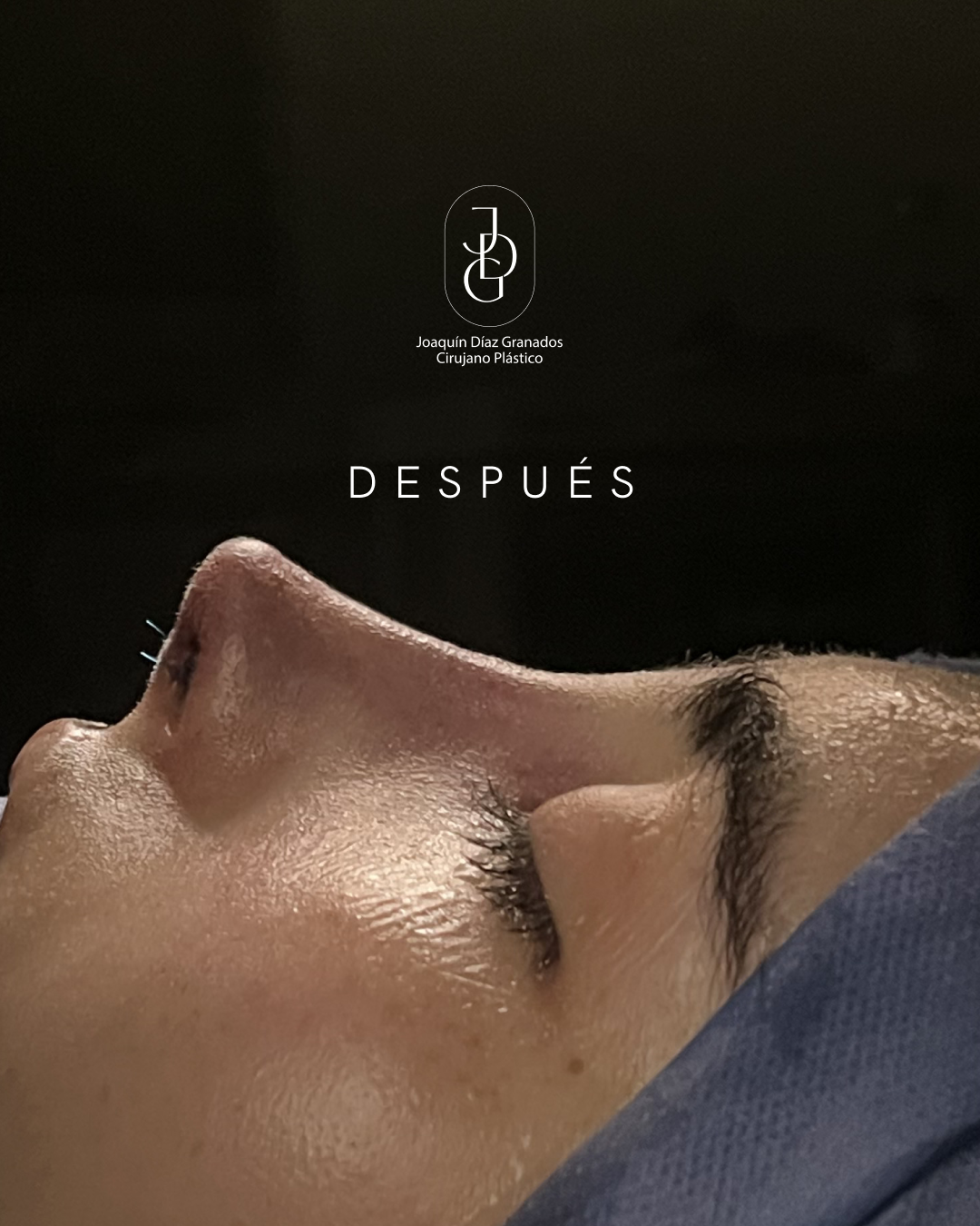 Despues